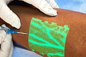 CLaCS Treatment