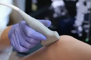 Doppler-Guided Vein Assessment